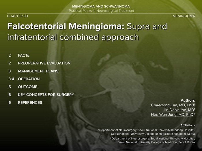 Falcotentorial Meningioma: Supra and Infratentorial Combined Approach