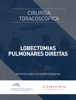 Videoatlas: Lobectomias Pulmonares Direitas - Instituto Lubeck de Ensino e Pesquisa