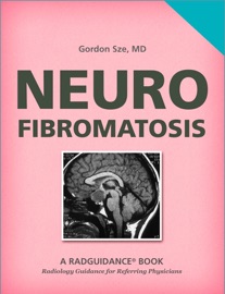 Neurofibromatosis - Gordon Sze, M.D.