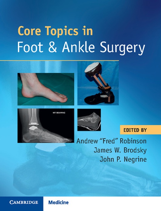 Core Topics in Foot & Ankle Surgery