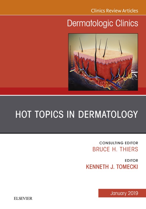 Hot Topics in Dermatology, An Issue of Dermatologic Clinics, Ebook