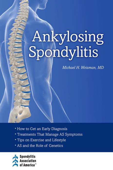 Ankylosing Spondylitis