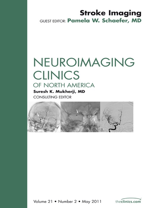 Imaging of Ischemic Stroke, An Issue of Neuroimaging Clinics - E-Book