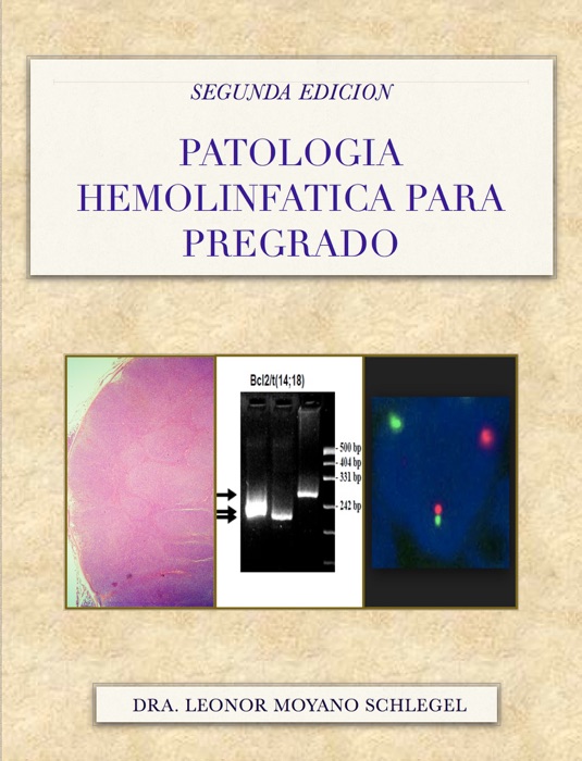 PATOLOGIA HEMOLINFATICA PARA PREGRADO