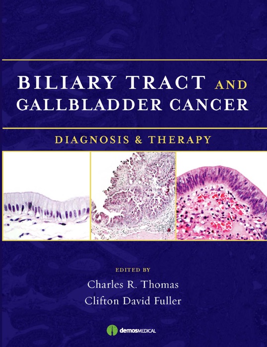 Biliary Tract and Gallbladder Cancer