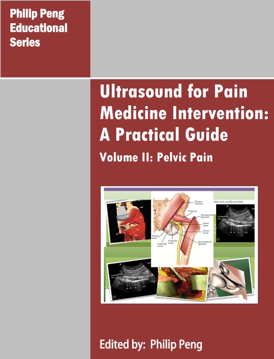 Ultrasound for Pain Medicine Intervention: A Practical Guide