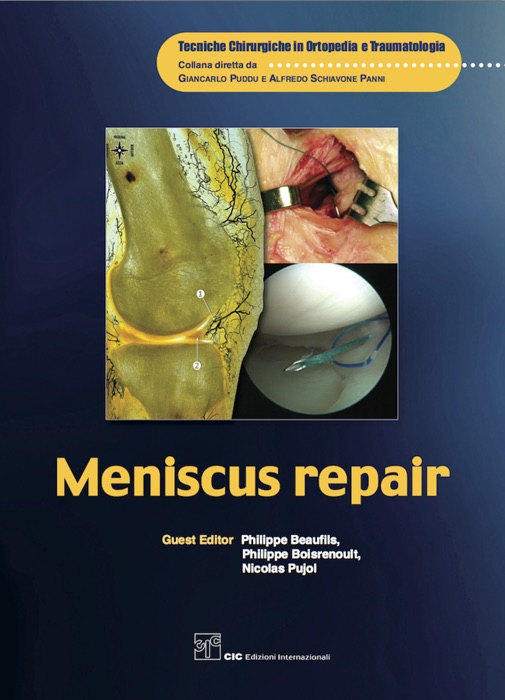 Meniscus repair