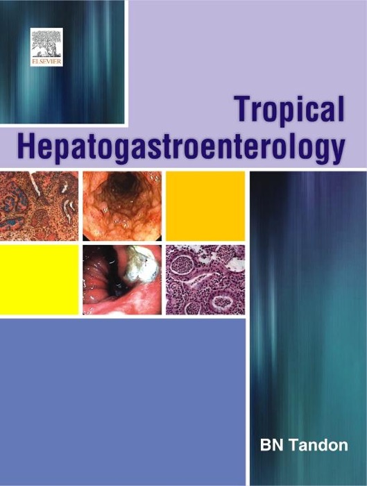 Tropical Hepato-Gastroenterology - E-Book