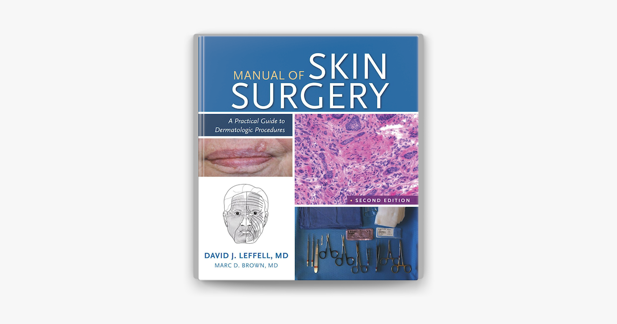 ‎Manual Of Skin Surgery: A Practical Guide To Dermatologic Procedures ...