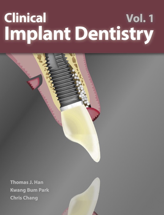 Clinical Implant Dentistry Vol. 1