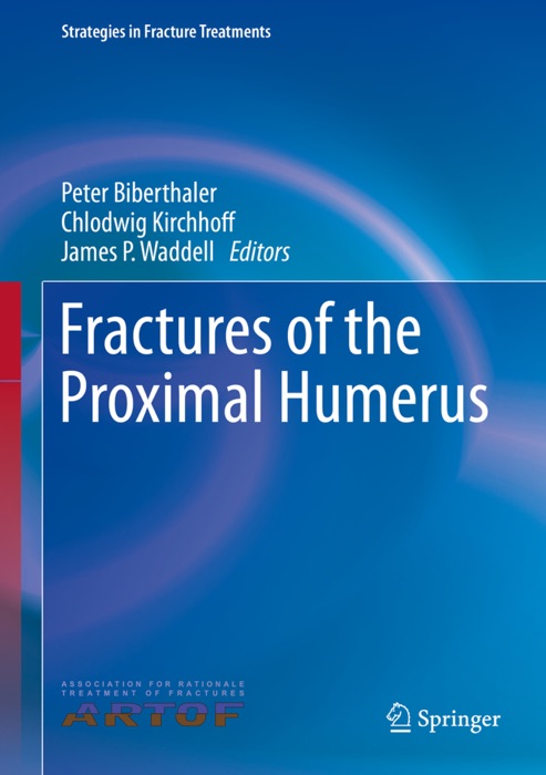 Fractures of the Proximal Humerus