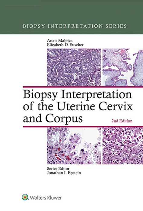Biopsy Interpretation of the Uterine Cervix and Corpus: Second Edition