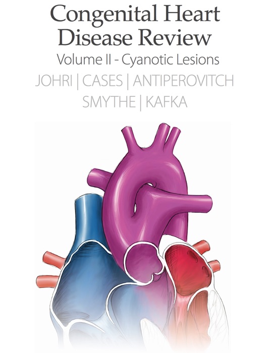 Congenital Heart Disease Review Vol. 2