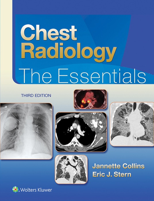 Chest Radiology: Third Edition