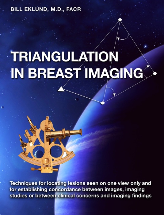 TRIANGULATION IN BREAST IMAGING