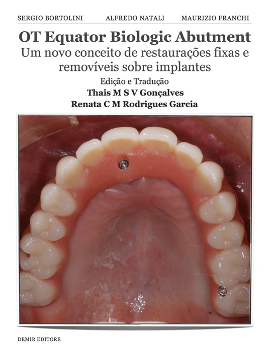 OT Equator Biologic Abutment