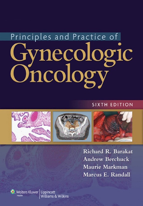 Principles and Practice of Gynecologic Oncology: Sixth Edition