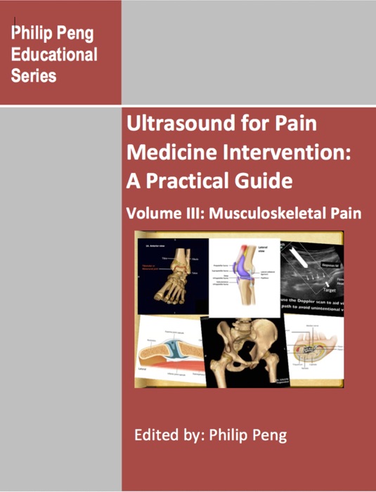 Ultrasound for Pain Medicine Intervention: A Practical Guide