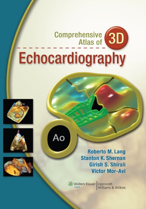 Comprehensive Atlas of 3D Echocardiography