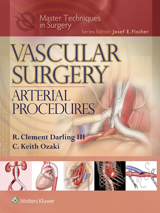 Vascular Surgery: Arterial Procedures