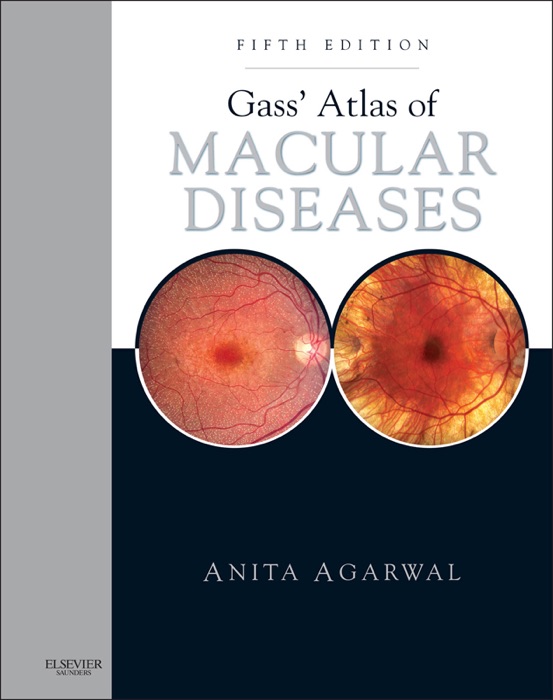 Gass' Atlas of Macular Diseases E-Book