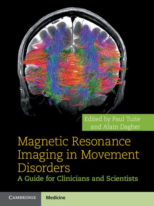 Magnetic Resonance Imaging in Movement Disorders