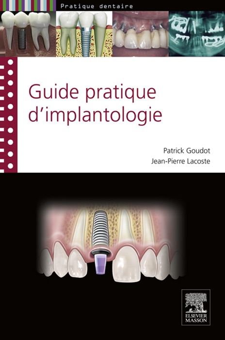 Guide pratique d'implantologie