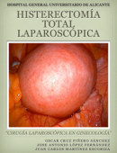 Histerectomía Total Laparoscópica - Oscar Cruz Piñero Sánchez, Jose Antonio López Fernández & Juan Carlos Martínez Escoriza