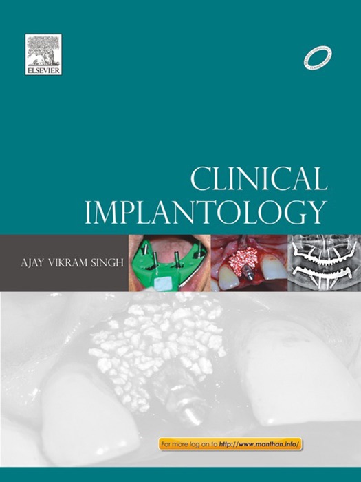 Clinical Implantology - E-Book