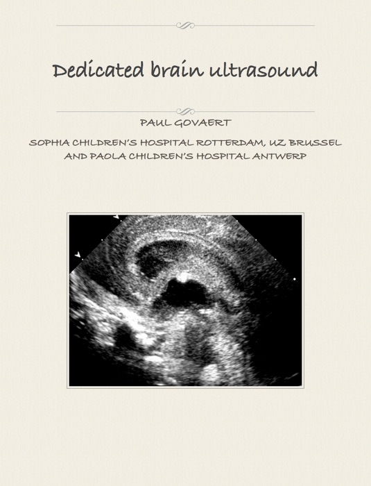 Dedicated Brain Ultrasound