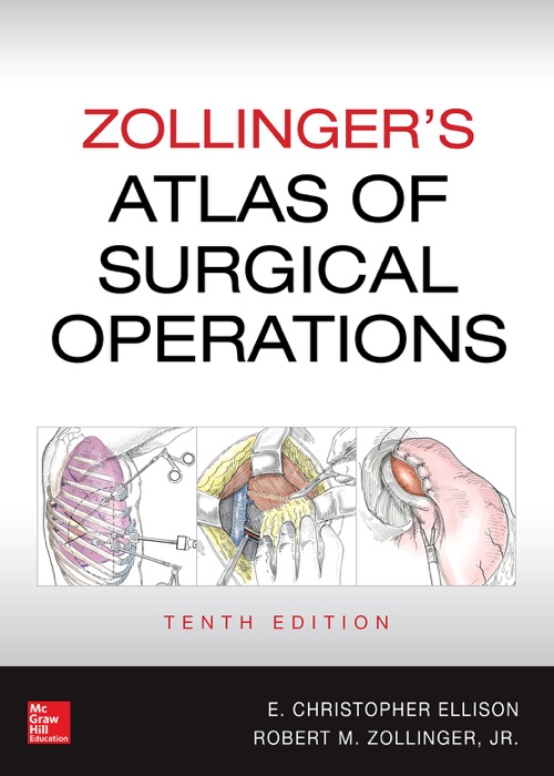Zollinger's Atlas of Surgical Operations, 10th edition