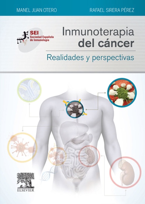 Inmunoterapia del cáncer. Realidades y perspectivas