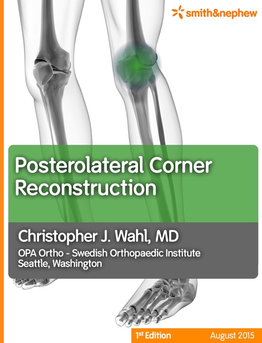 Posterolateral Corner Reconstruction