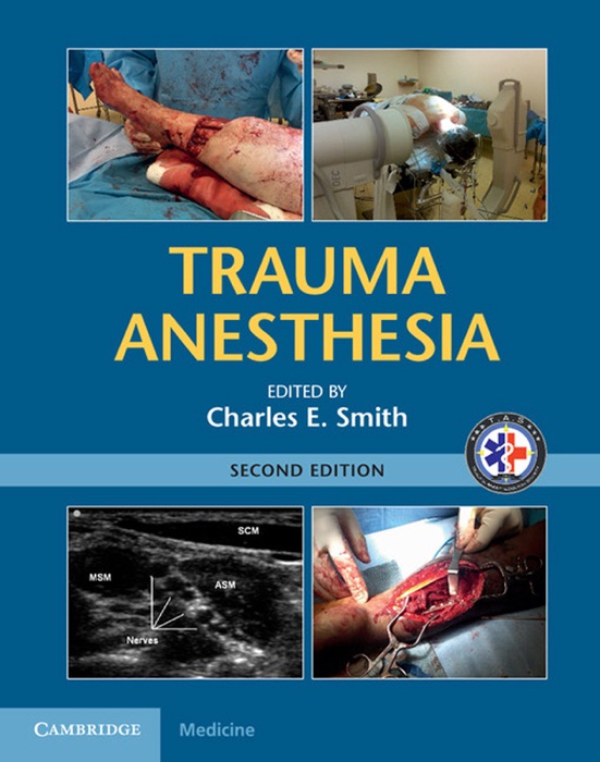 Trauma Anesthesia: Second Edition