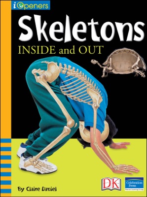 iOpener: Skeletons Inside and Out