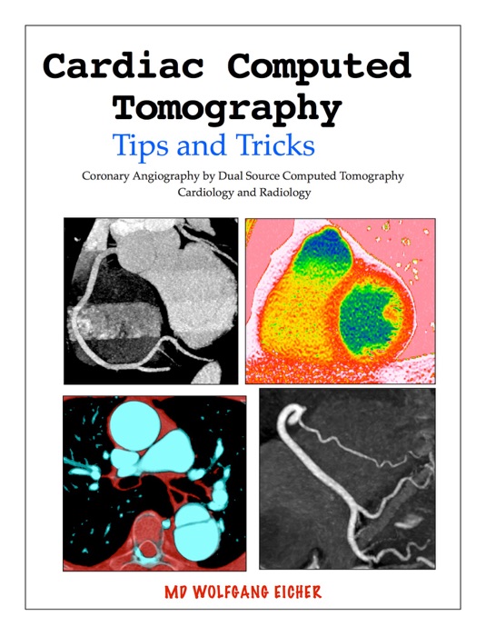 Cardiac Computed Tomography