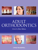 Adult Orthodontics - Birte Melsen