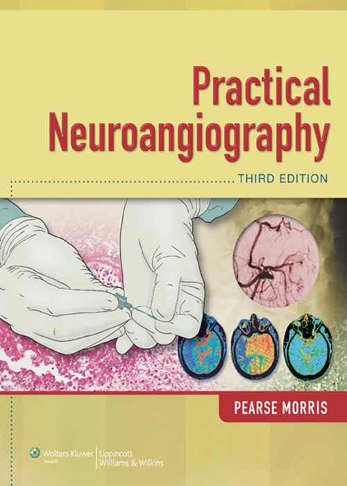 Practical Neuroangiography: Third Edition