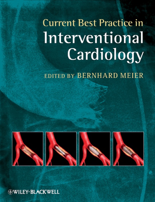 Current Best Practice in Interventional Cardiology