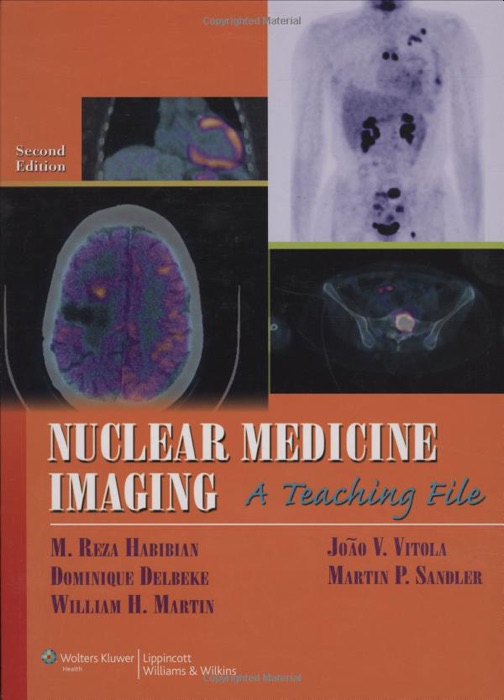 Nuclear Medicine Imaging: Second Edition