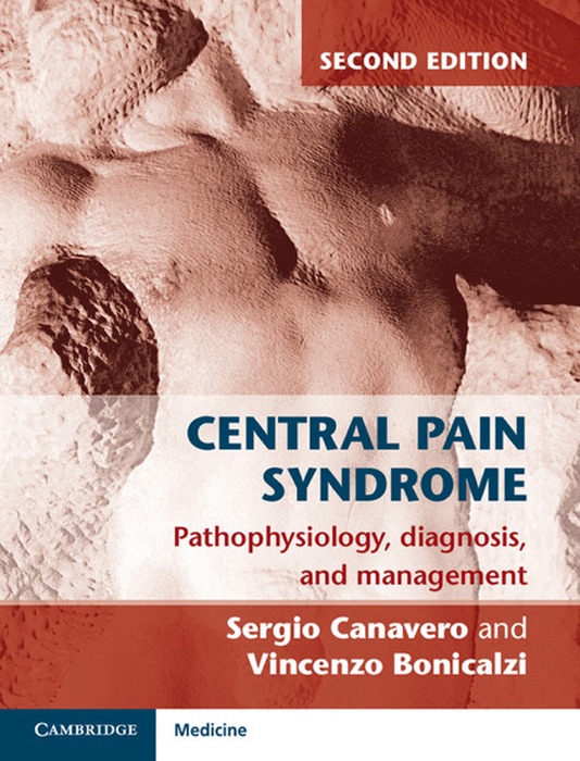 Central Pain Syndrome