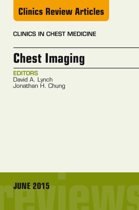 Chest Imaging, An Issue of Clinics in Chest Medicine, E-Book
