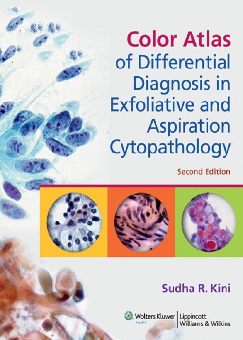 Color Atlas of Differential Diagnosis in Exfoliative and Aspiration Cytopathology: Second Edition