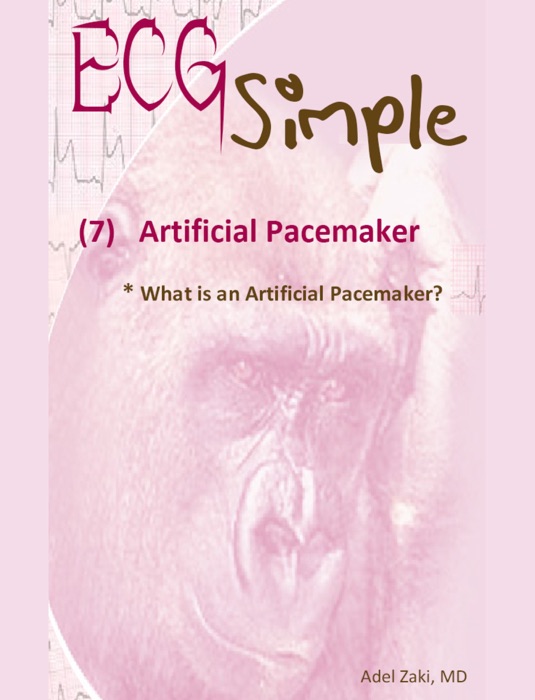 ECG simple (7) Artificial Pacemaker