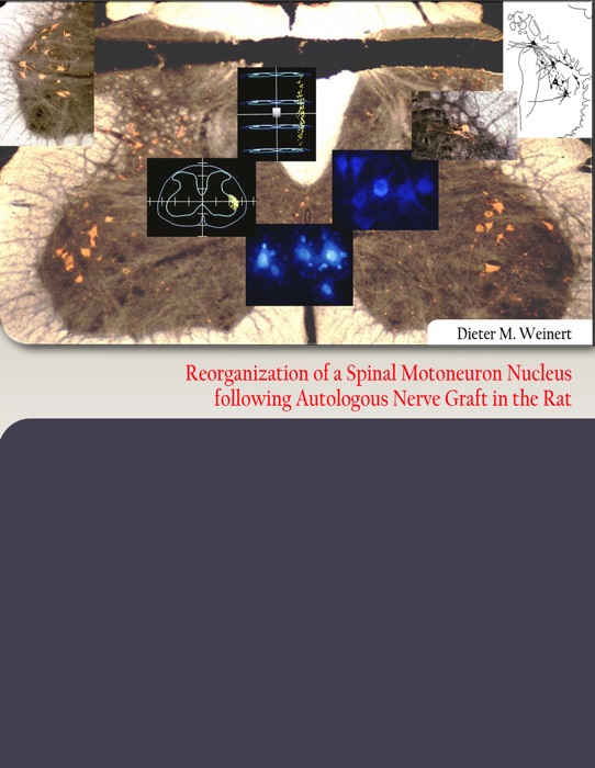 Reorganization of  a Spinal Motoneuron Nucleus following Autologous Nerve Graft in the Rat