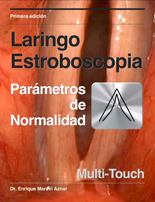 Laringo Estroboscopia