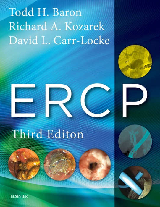 ERCP