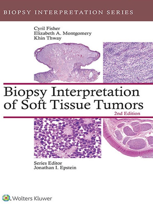 Biopsy Interpretation of Soft Tissue Tumors: 2nd Edition
