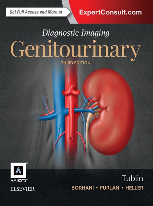 Diagnostic Imaging: Genitourinary E-Book