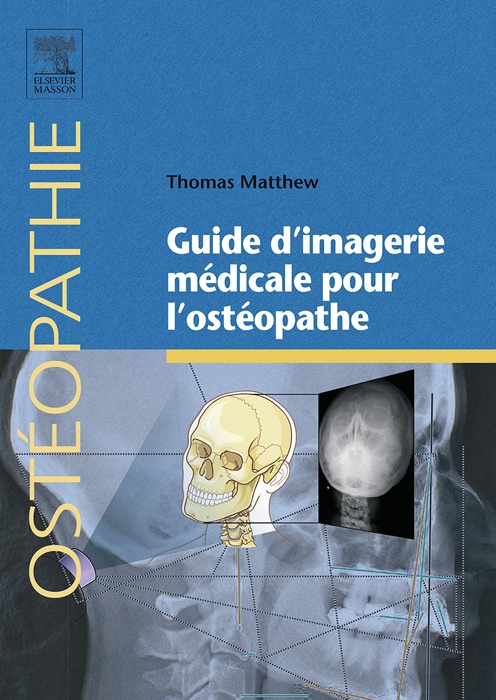 Guide d’imagerie médicale pour l’ostéopathe